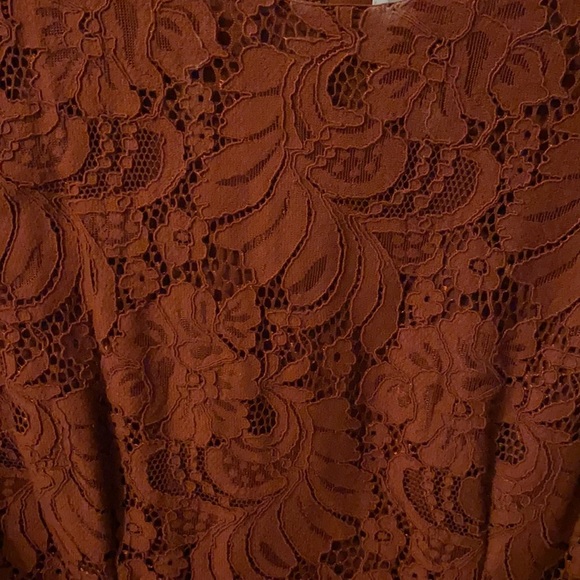 H&M Lace Midi Dress - Picture 3 of 4